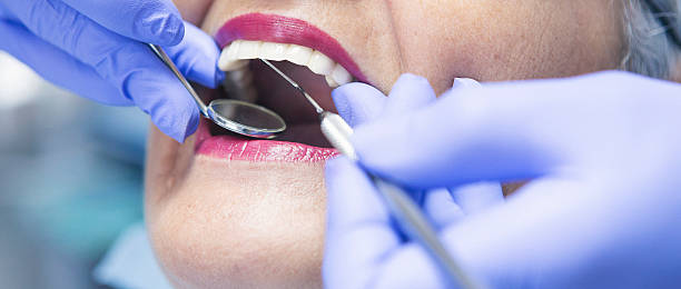 Best Emergency Dental Extractions in Rockville, IN